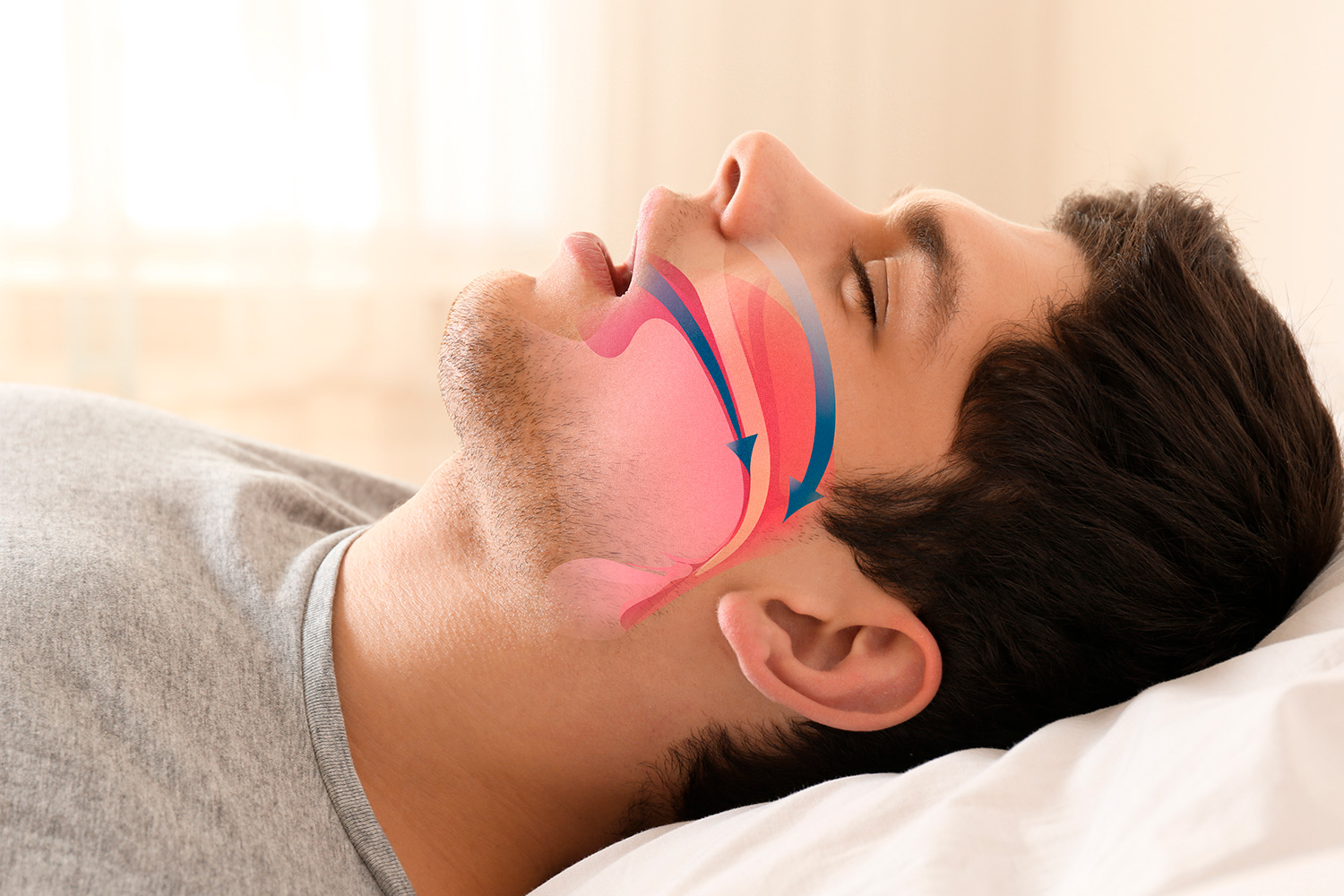 Que Es Apnea Respiratoria En Natacion Login Pages Info Que Es Apnea Respiratoria En Natacion Login Pages Info