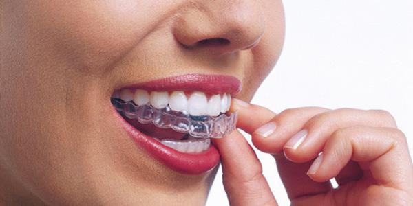 Invisalign