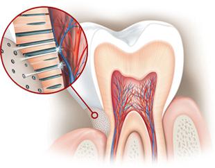 sensibilidad dental1