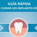 Guía para el cuidado de los implantes dentales