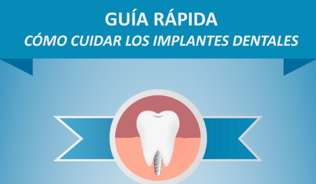 Guía para el cuidado de los implantes dentales