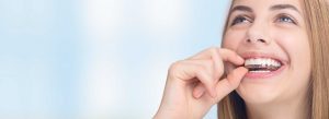ortodoncia invisible para adolescentes