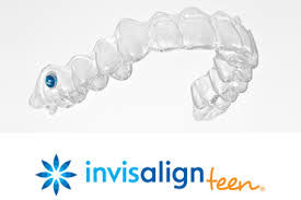 Invisalign TEEN: indicador de cumplimiento