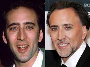odontologia Nicolas Cage