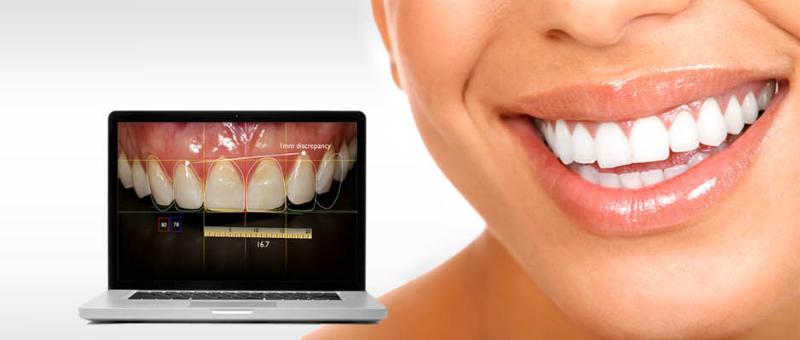 Diseño de Sonrisa Digital: el antes y el después