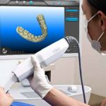 escaner intraoral dentista Barcelona
