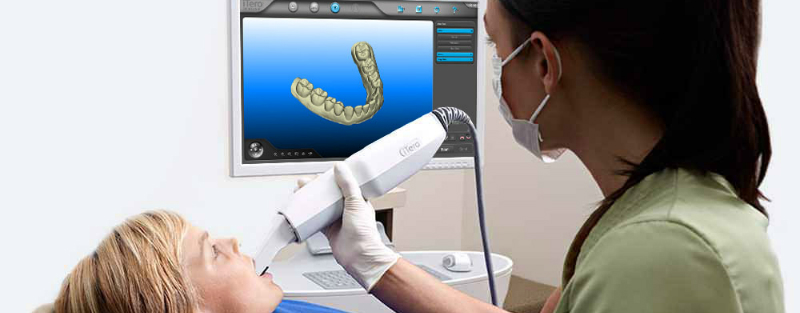 escaner intraoral dentista Barcelona
