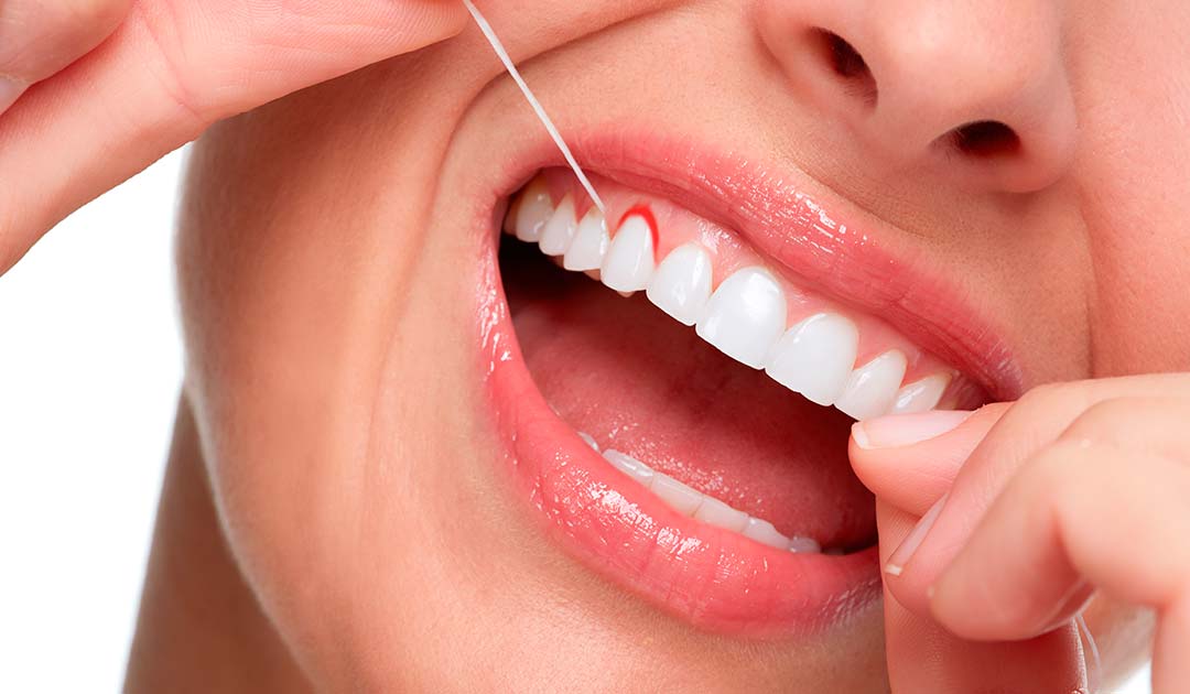 Por sangran las encías? - Clínica Aguilar Dental