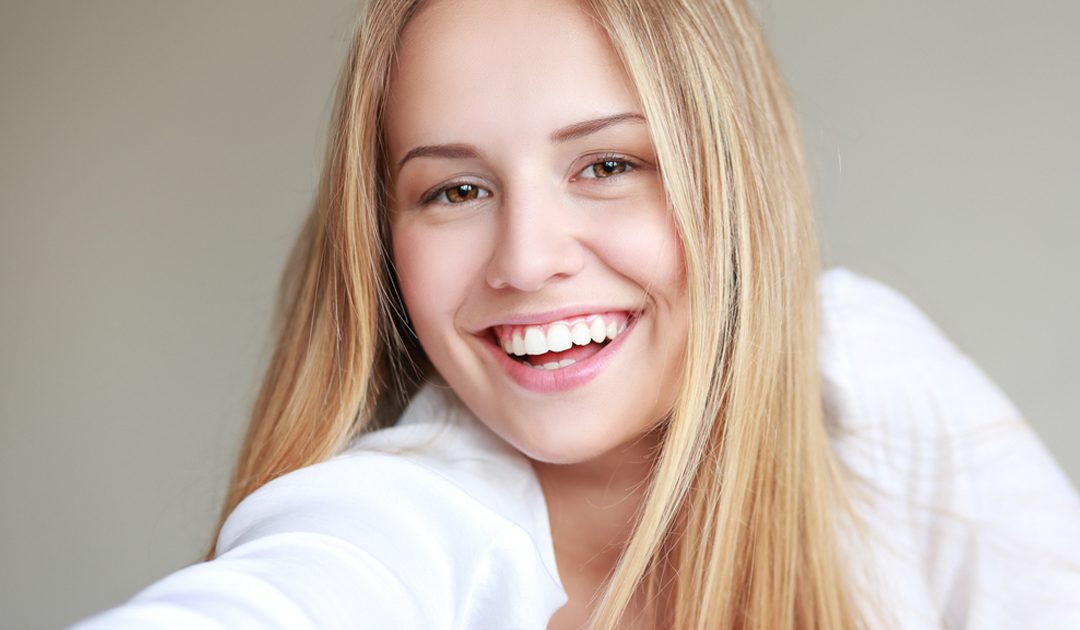 Invisalign® Teen con Avance Mandibular, la última innovación en ortodoncia para adolescentes