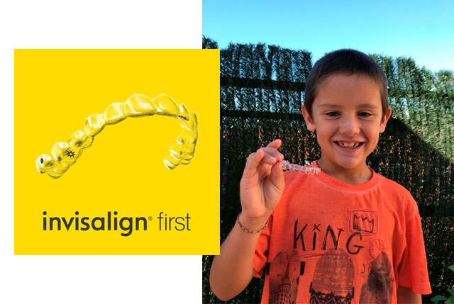 ¡Invisalign First, ahora ortodoncia invisible también en niños!