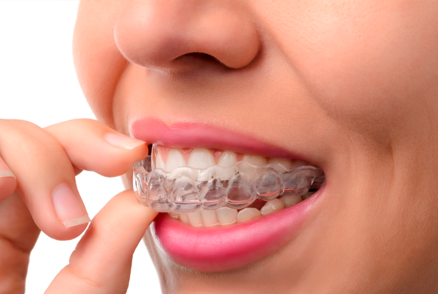 Invisalign boca Aguilar Dental