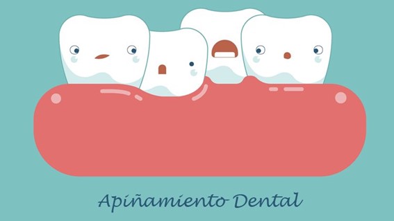 Por qué se tiene los dientes apiñados y cómo solucionarlo