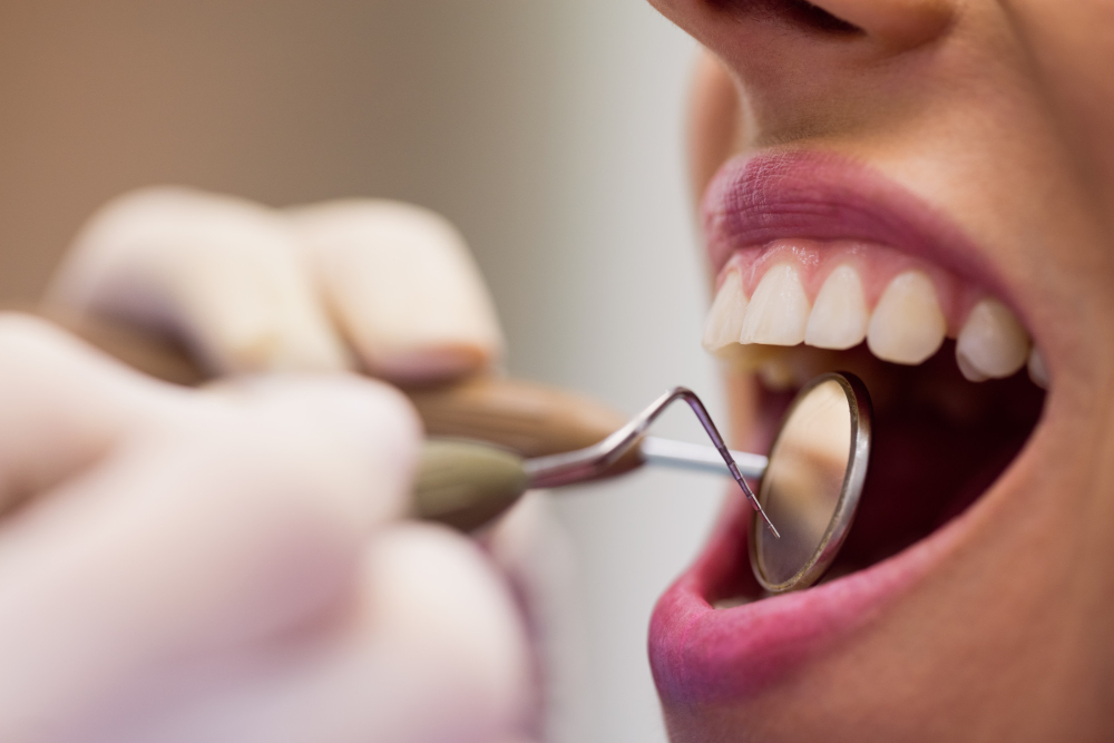 Cómo no tener caries: 3 consejos que funcionan