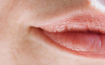 Un mucocele en el labio: ¿qué es y por qué lo tienes?
