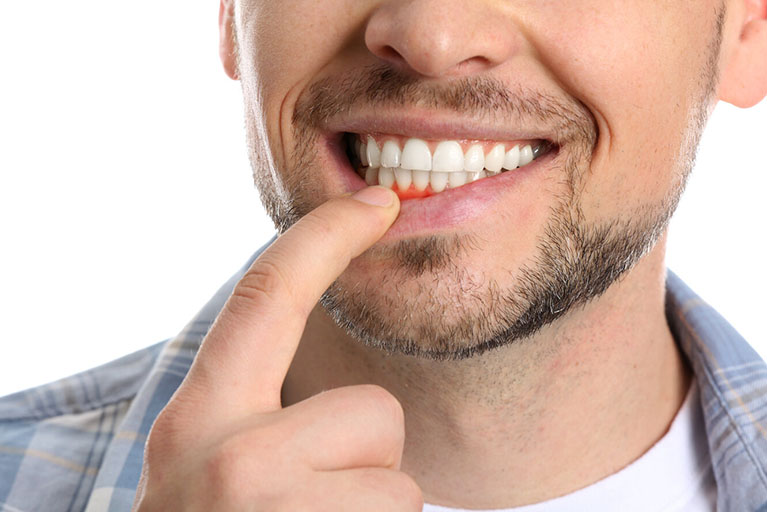 ¿Encías Inflamadas? Descubre por qué.