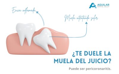 ¿Te duele la muela del juicio? Puede ser pericoronaritis